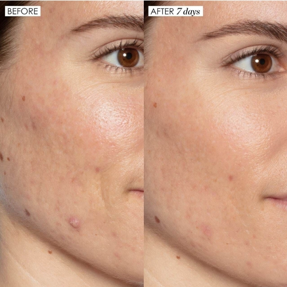 Sunday Riley Lactic Acid Treatment (mini) - Picture 3 of 6